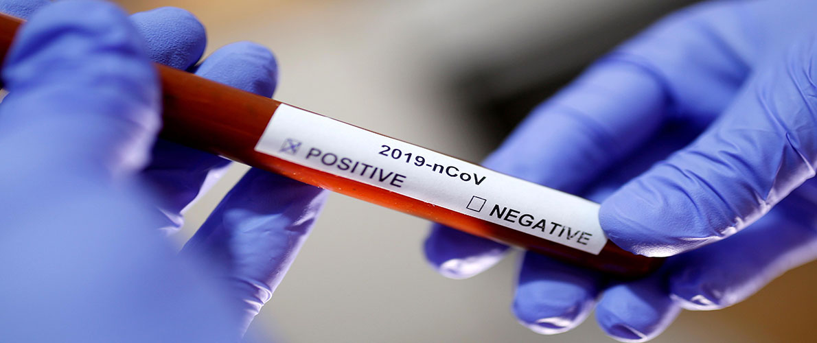 إمكانية الاستنجاد بالفنادق والتحاليل بالمخابر الخاصة مسموحة 