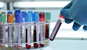 تحقيقات وبائية بالولايات التي تسجل أكبر عدد الإصابات بكورونا