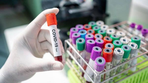 مستشفى سطيف يشرع في إجراء تحاليل كورونا